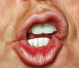 mouth